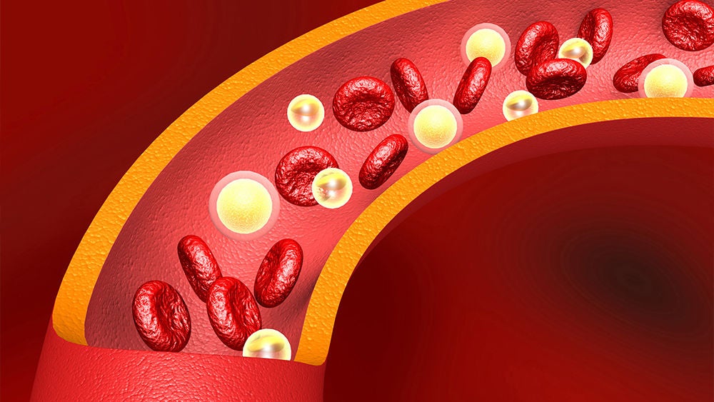 Eine Grafik zeigt Cholesterin und Blutplättchen in einem Blutgefäß.