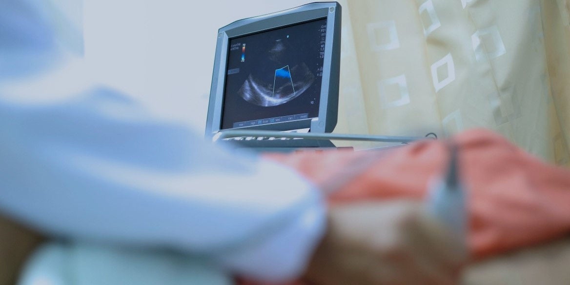 Echokardiographie - Ultraschalluntersuchung des Herzens