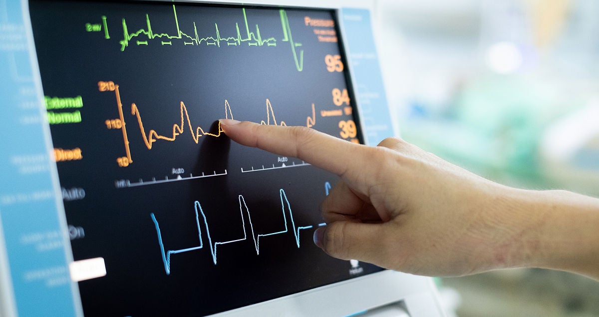 Zeigefinger zeigt auf EKG-Bildschirm, Bildquelle: Adobe Stock/Koragot kaewmahakhun