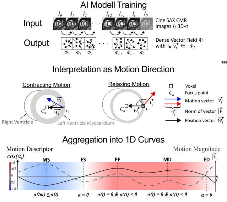 Übersicht Myocardial motion descriptor