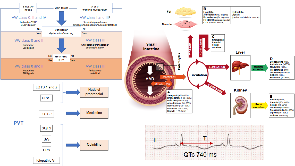 Anwendung und Wirkung von Antiarrhythmika