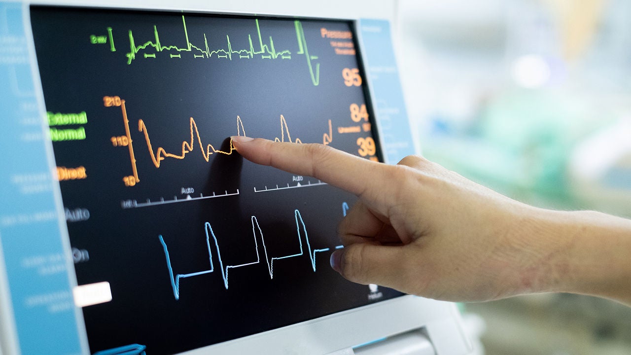 Zeigefinger zeigt auf EKG-Bildschirm, Bildquelle: Adobe Stock/Koragot kaewmahakhun