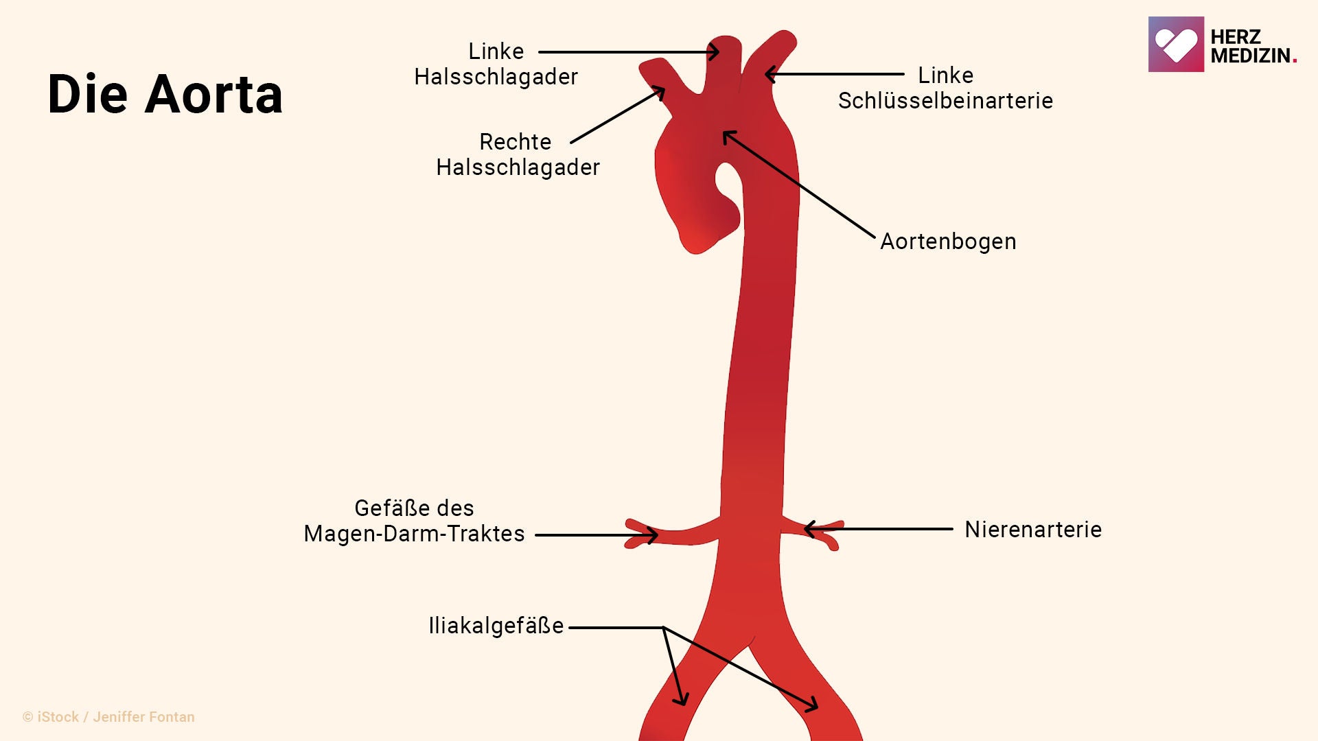 Eine Grafik zeigt den Verlauf der Aorta im Körper.