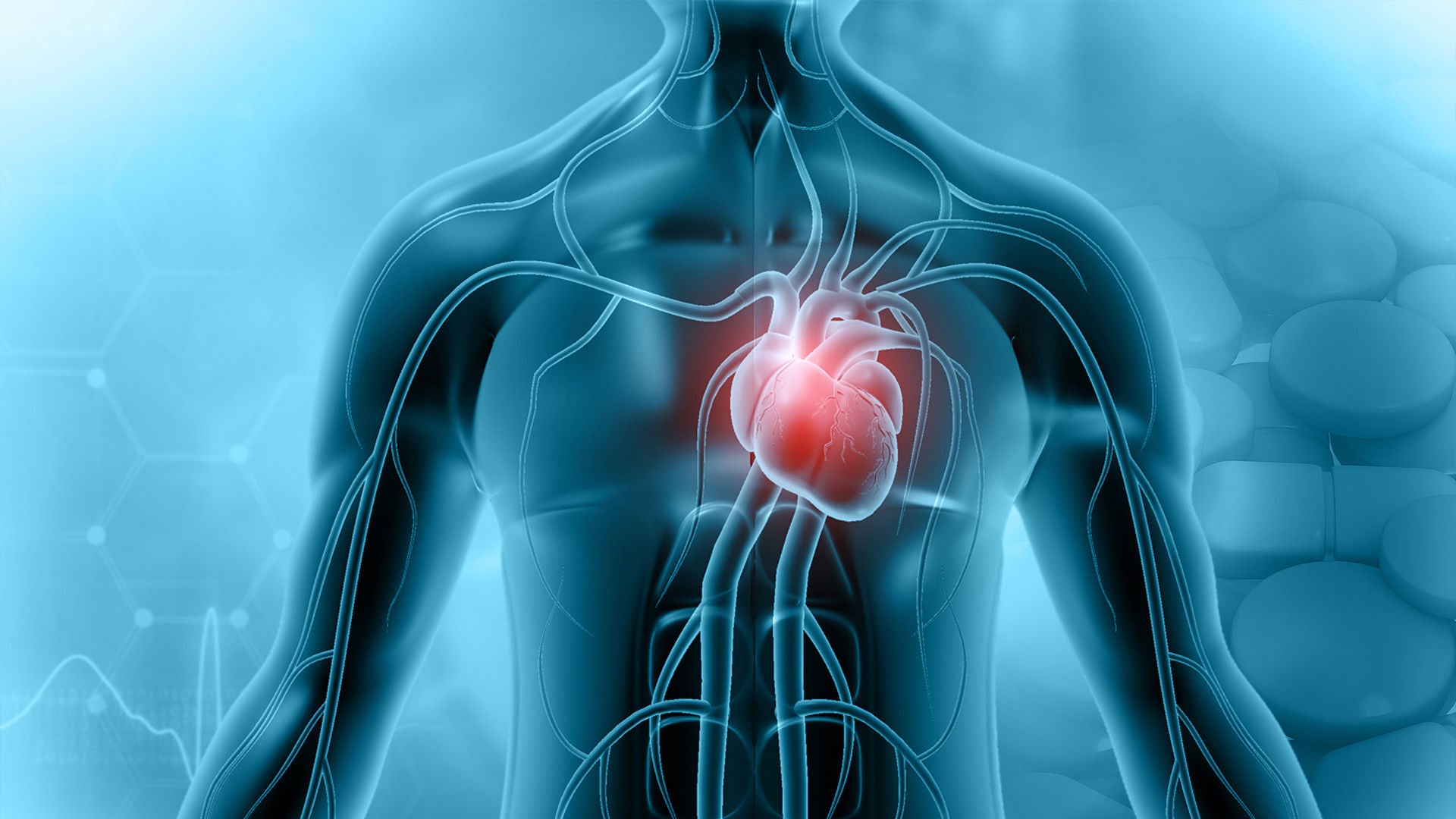 Eine Herzmuskelentzündung kann die Pumpfunktion des Herzens beeinträchtigen.
