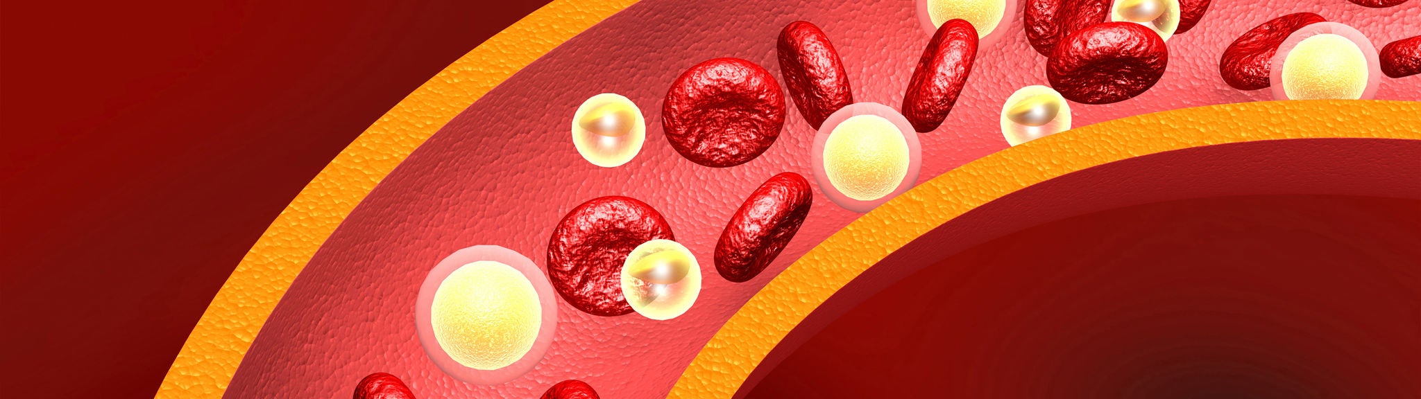 Eine Grafik zeigt Cholesterin und Blutplättchen in einem Blutgefäß.