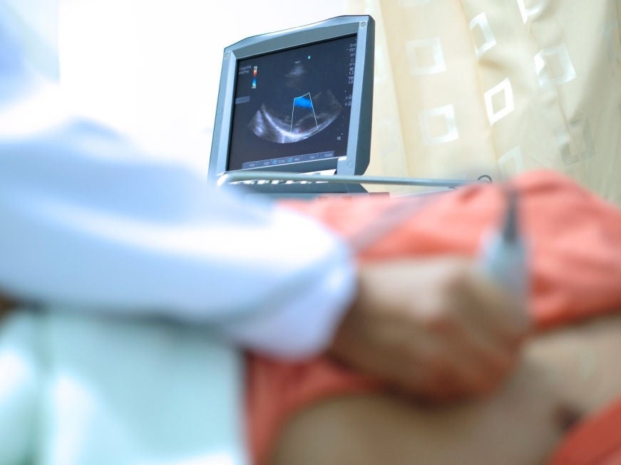 Echokardiographie - Ultraschalluntersuchung des Herzens