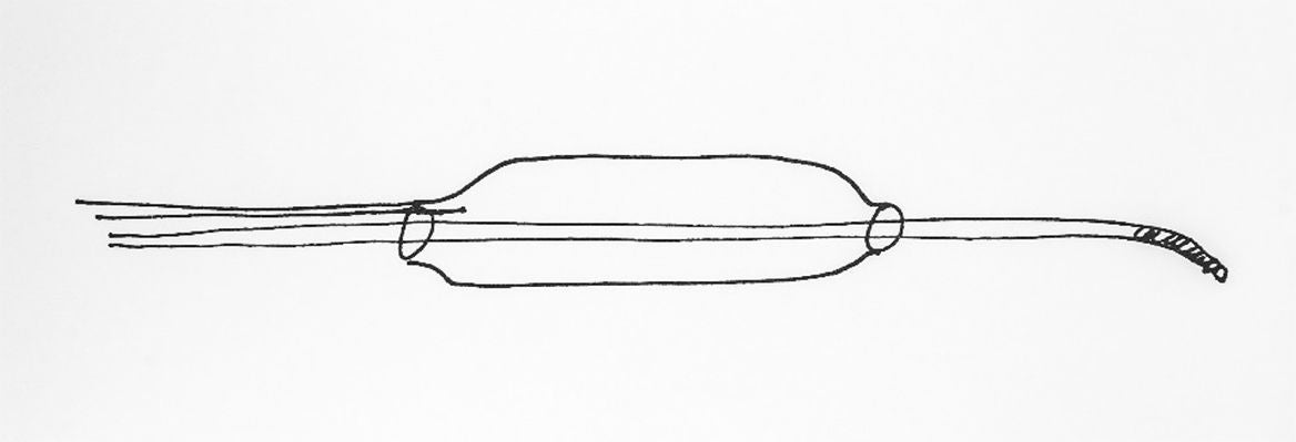 Skizze eines Monorail-Ballonkatheters