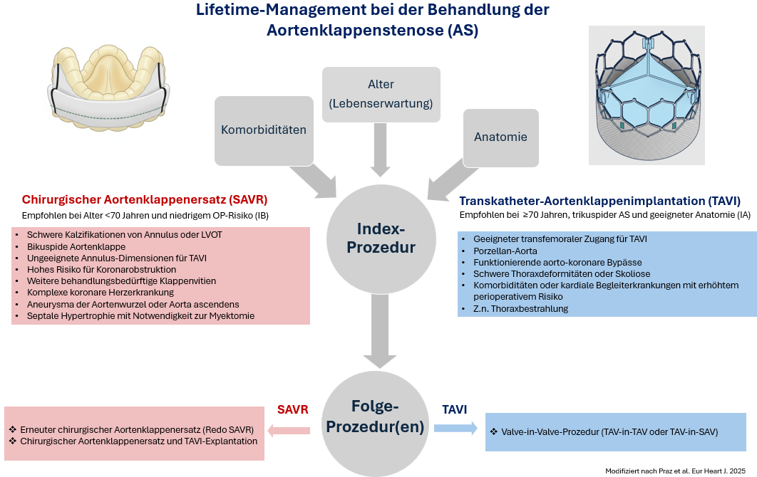 Lifetime-Management bei der Behandlung der Aortenklappenstenose (AS) 
