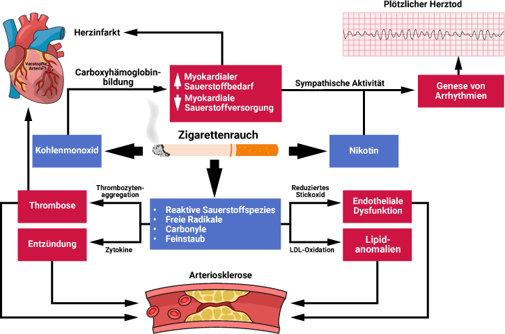 Herz-Kreislauf-Erkrankungen, die durch Rauchen verursacht werden