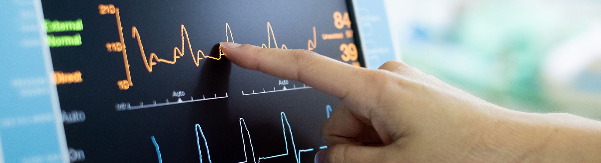 Zeigefinger zeigt auf EKG-Bildschirm, Bildquelle: Adobe Stock/Koragot kaewmahakhun 