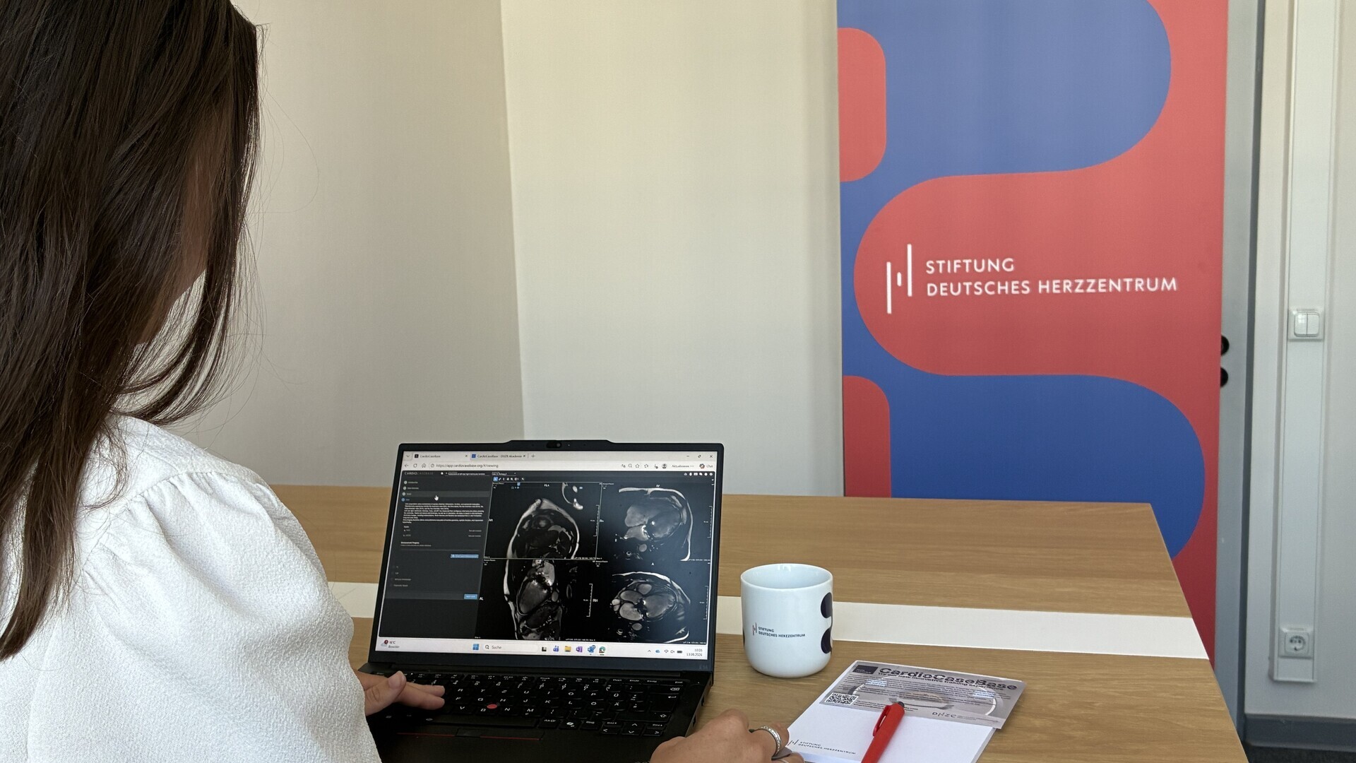 CardioCaseBase – Fallbasiertes CMR-Training