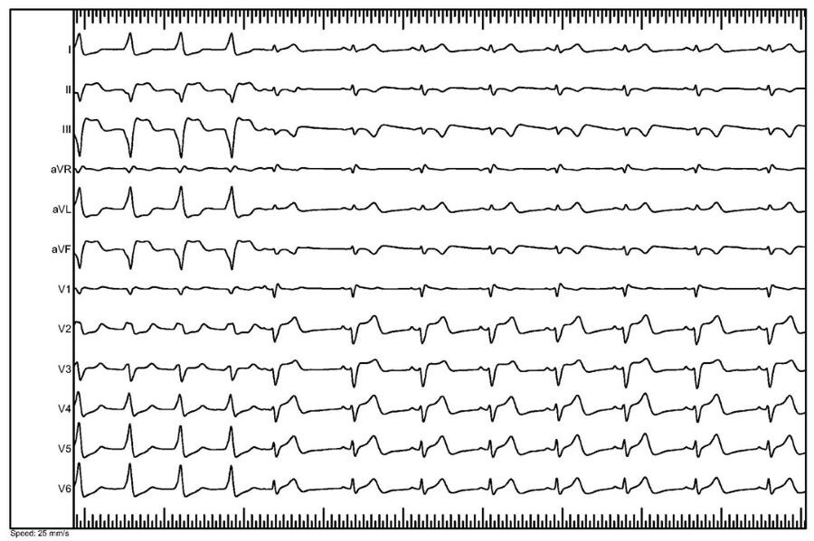 Bild EP-Fall 10_2.png