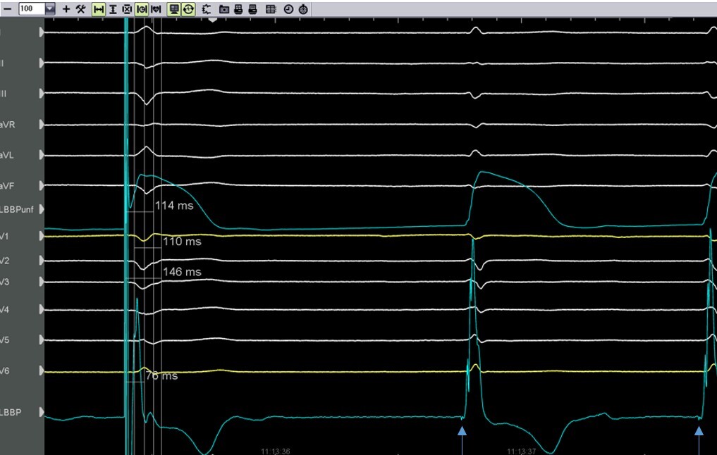 12Kanal-EKG