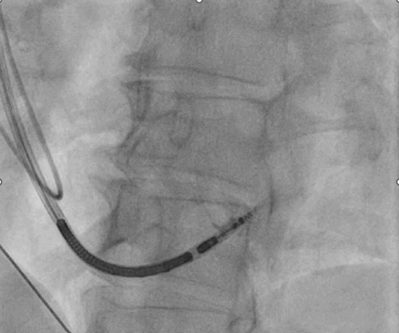Interoperative KM-Darstellung 