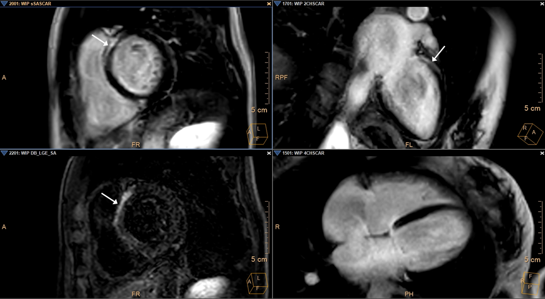 Kardiovaskuläres MRT