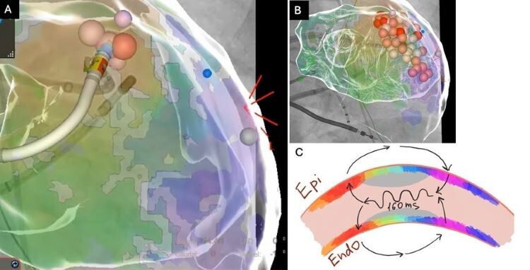Bild EP Fall März 2-3