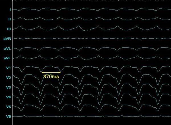 Bild EP Fall März 2