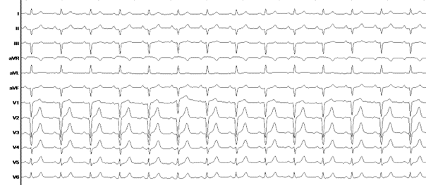 Grafik EP-Fall August 1