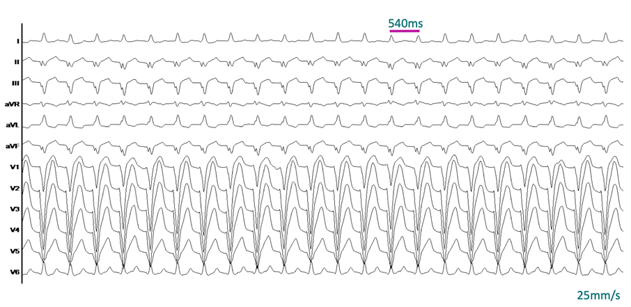 Grafik EP-Fall August 2