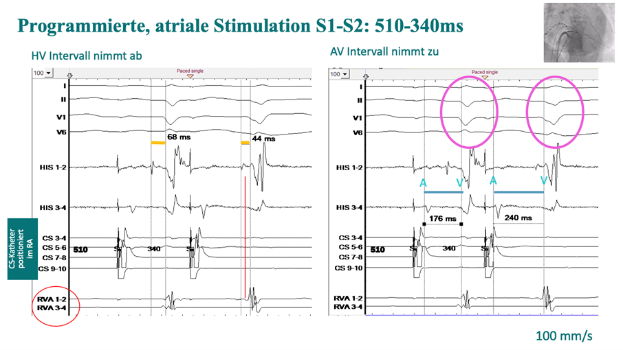Grafik EP-Fall August 3