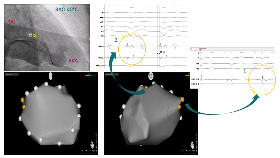 Grafik EP-Fall August 4