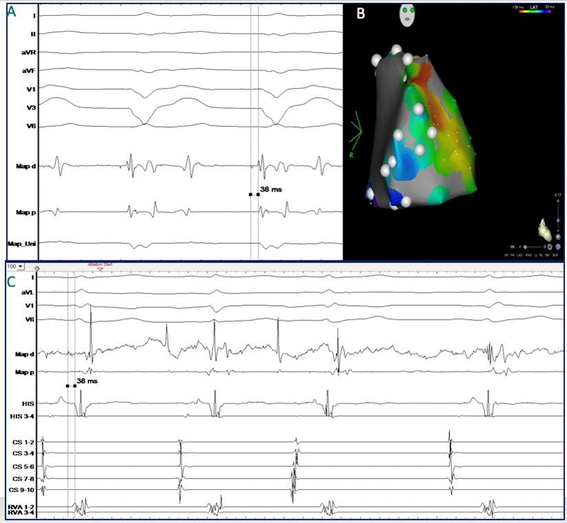 Grafik EP-Fall August 5