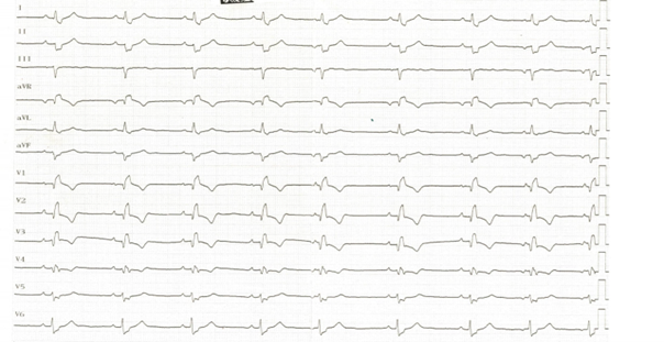 Grafik EP-Fall August 6