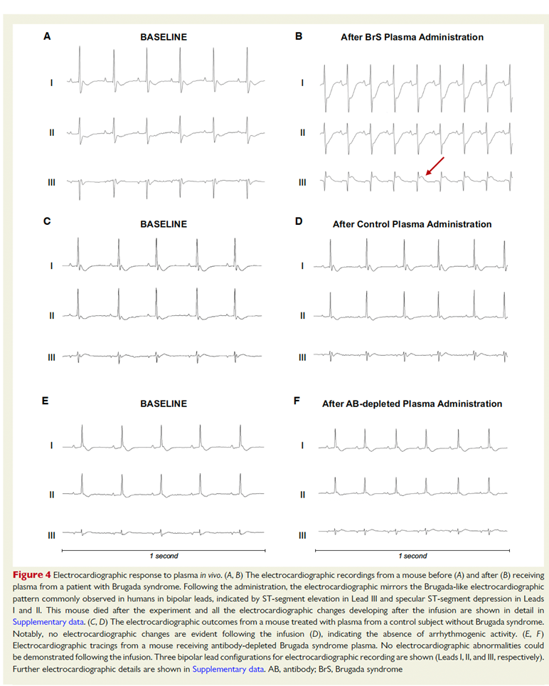 POM  September Grafik 2