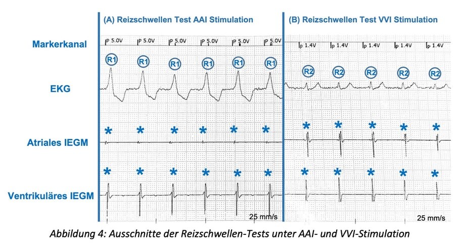 4_Reizschwlellen-Test