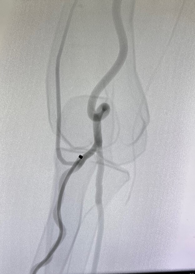 Abb. 5 Komplexe radiale Anatomie