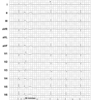 EP-Fall-des-Monats_2024_05_23_373x413px