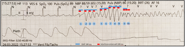 EP Fall des Monats_2024_05_23_3