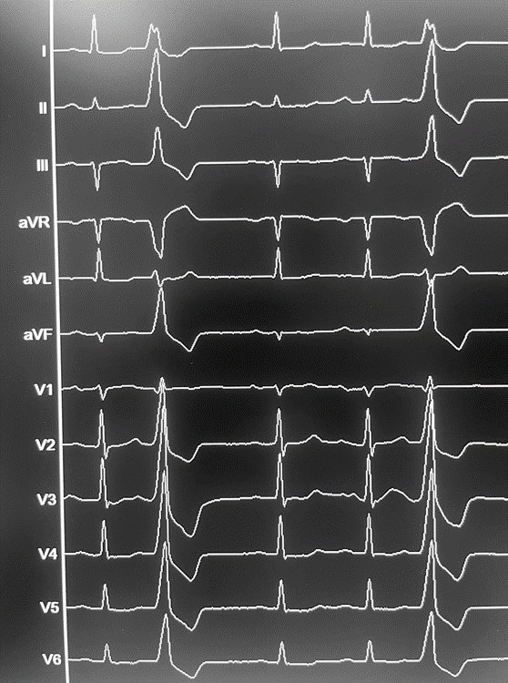 EP Fall des Monats_2024_06_11_1