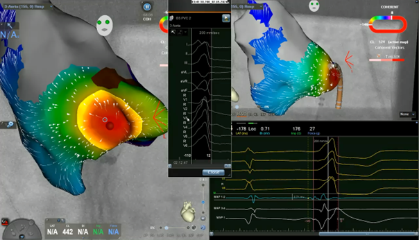 EP Fall des Monats_2024_06_11_2