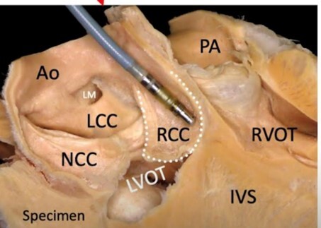 EP-Fall des Monats_2024_06_11_3