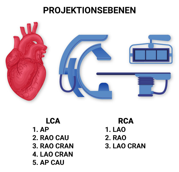 Standardebenen bei einer diagnostischen Koronarangiographie für die LCA und RCA 