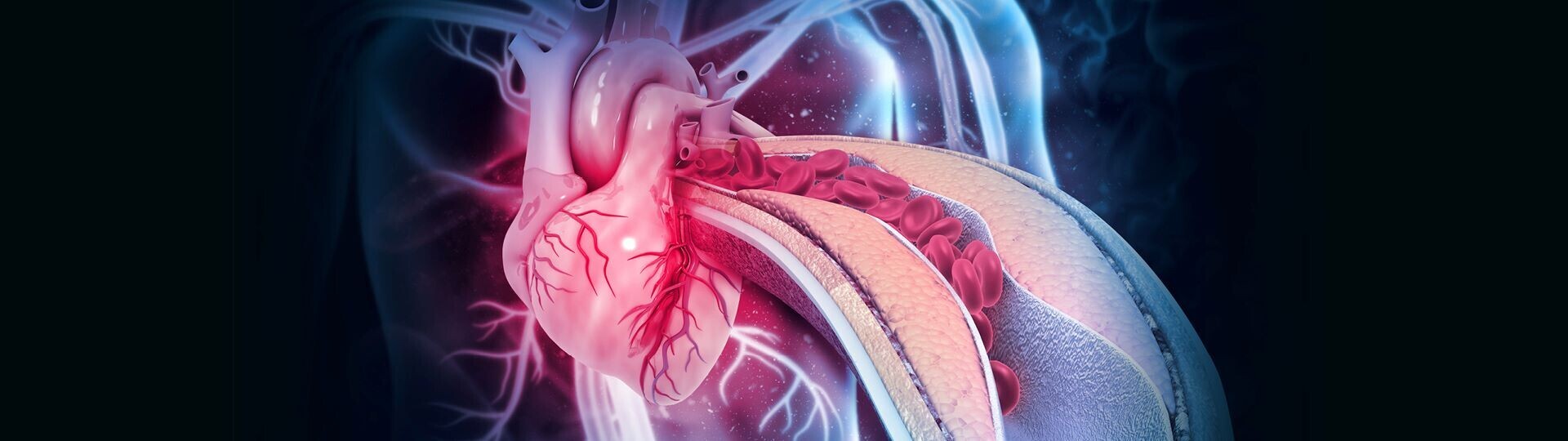 PBI_JAI_25012_Herzmedizin_Atherosklerose_1920x540_V1