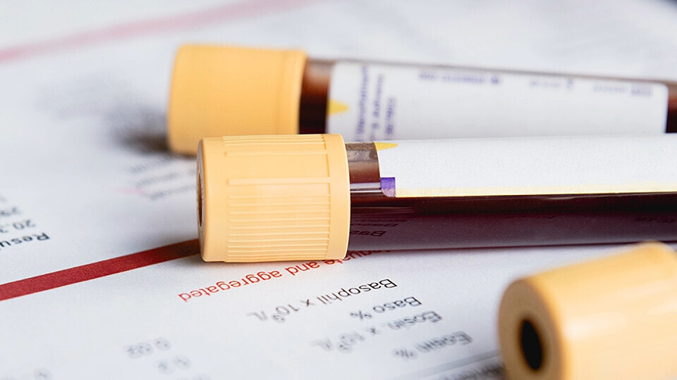 blutprobe-header-32zu9-1920x540