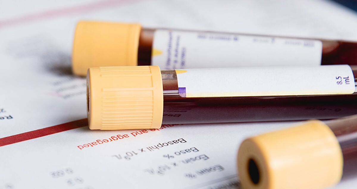 Blutproben-Art-16zu9-1200x635