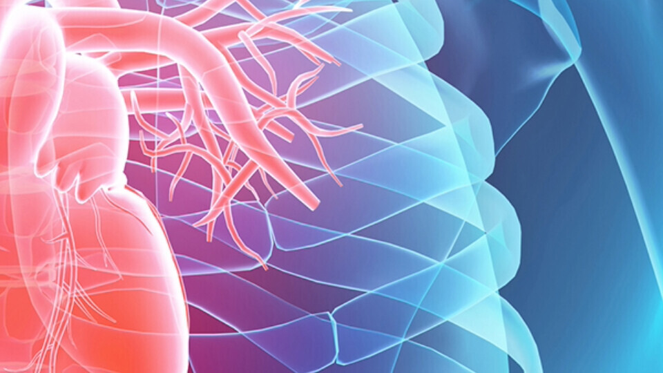 vorhofflimmern-header-32zu9-1920x540