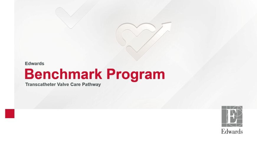 benchmark-kampagne-edwards-16zu9-871x490