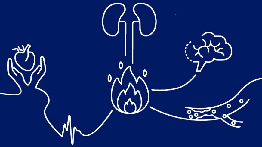 Teasergrafik-16zu9-871x490