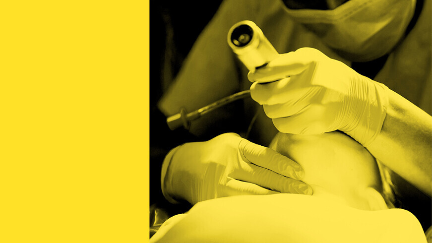 Anästhesist bei der Intubation