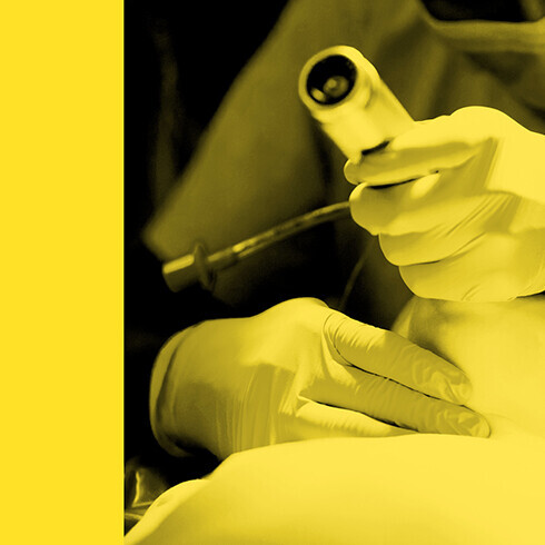 Anästhesist bei der Intubation