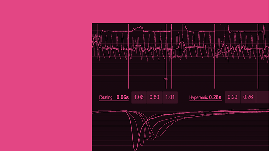 Monitor mit koronarer Untersuchung der Flussreserve und des Widerstands.