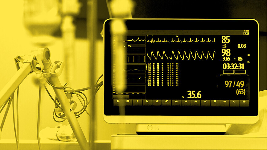 Herzfrequenzmesser in einem Operationssaal