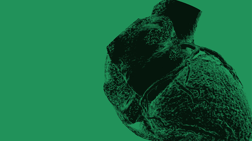 kardio-ct-Pijitra–stock.adobe-464527285-16zu9-871x490