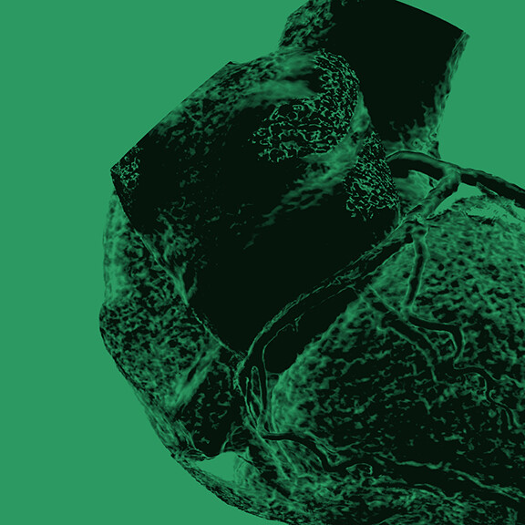 kardio-ct-Pijitra–stock.adobe-464527285-1zu1-576x576