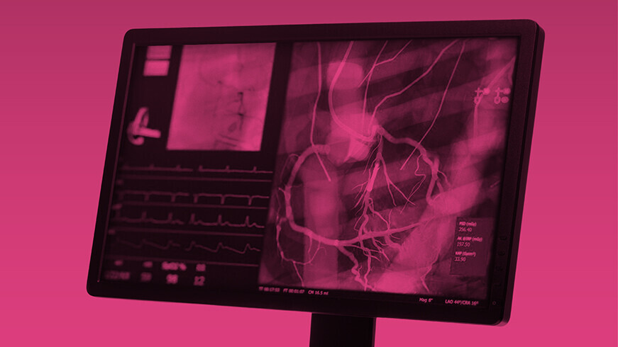 Monitor mit Daten Koronarangiographie
