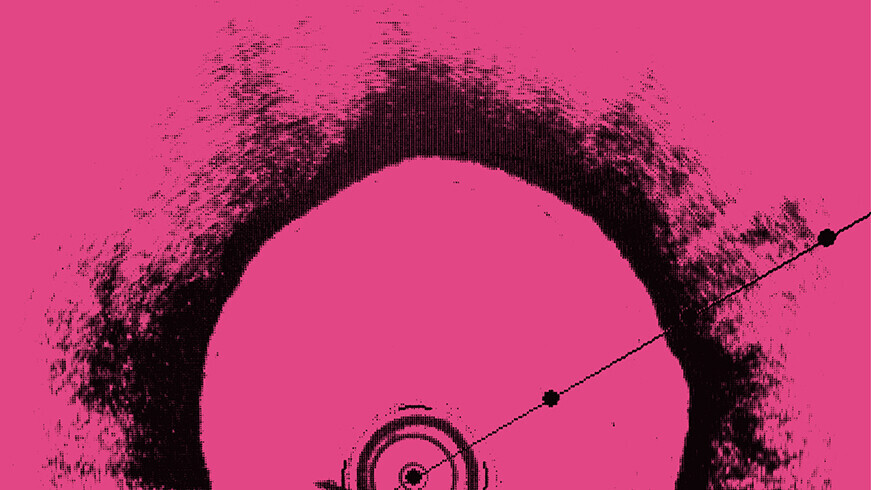 Intravaskuläre Bildgebung mit optischer Kohärenztomographie